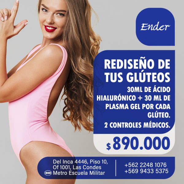 ENDER035