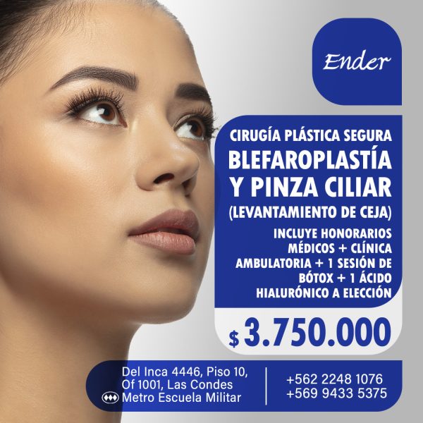ENDER036